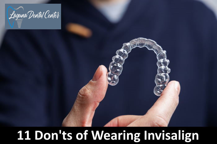 11 Things You Cannot Do With Invisalign
