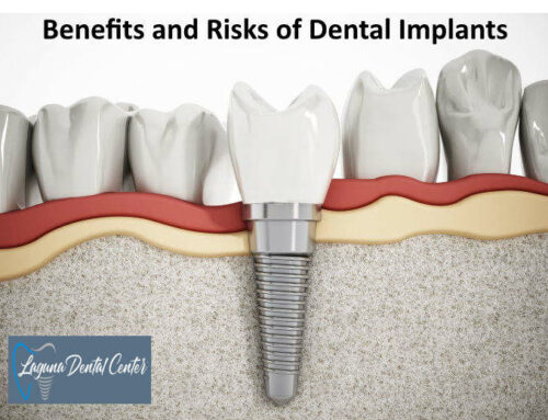 What Are The Benefits and Risks of Dental Implants