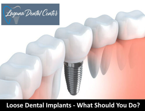 What To Do If Your Dental Implants Become Loose?