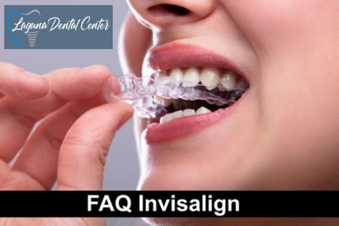 12 Things You Can Do With Invisalign