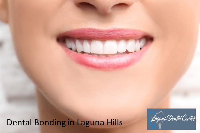 Dr. Ron Ayzin Dental Bonding Provider for Laguna Hills community