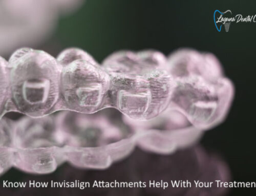 How Do Invisalign Attachments Help With Your Treatment?