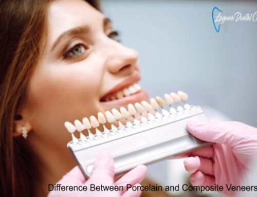 Difference Between Porcelain and Composite Veneers