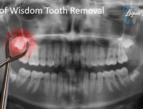 What are the Risks of Wisdom Teeth Extraction?