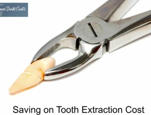 How to Save Money on Tooth Extraction?
