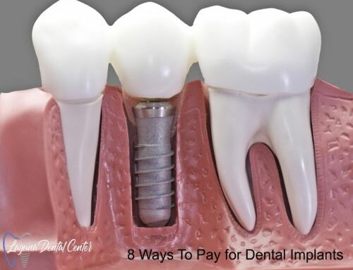 How to save money on Dental Implants Procedure?