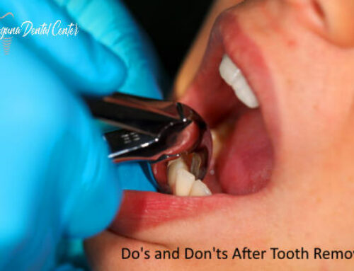 What Are the Do’s and Don’ts After a Tooth Extraction?